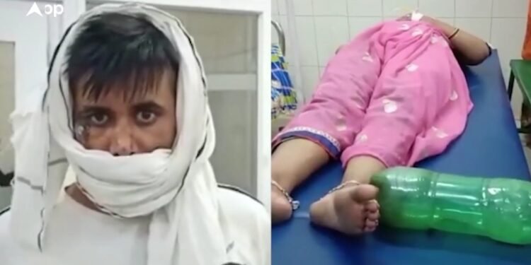 साँप ने महिला को काटा , पति ने बोतल में बंद कर लिया सांप , डॉक्टर नजारा देख रह गए दंग