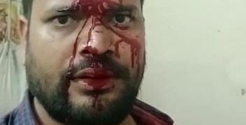 ग्रामीणों ने विद्युत जेई पर किया जानलेवा हमला, जेई बुरी तरह से घायल