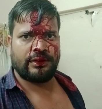 ग्रामीणों ने विद्युत जेई पर किया जानलेवा हमला, जेई बुरी तरह से घायल