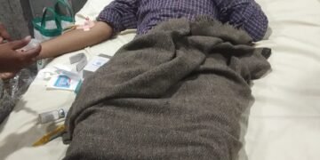 मामूली विवाद में दबंगों ने एक युवक पर रास्ते में घेर कर लाठी-डंडों से किया हमला ,