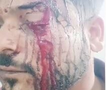 दुकान मालिक के कर्मचारी के साथ दबंगो ने की मारपीट