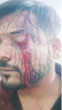 दुकान मालिक के कर्मचारी के साथ दबंगो ने की मारपीट