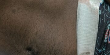 मंदिर के पास बैठे युवक को गोली मारने का आरोप,