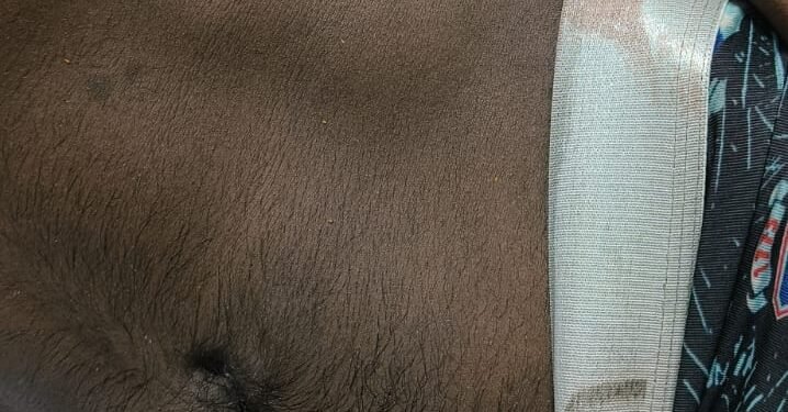 मंदिर के पास बैठे युवक को गोली मारने का आरोप,